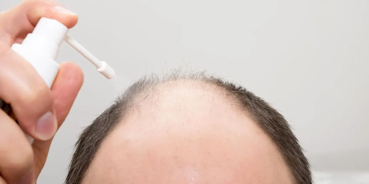 How Hair Patch Solution Gives You a Natural Look Instantly
