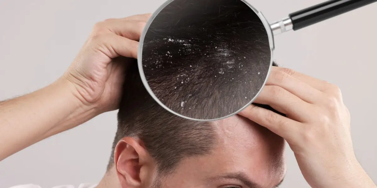 Hair Weaving Centre in Delhi